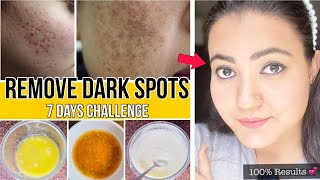 Remove dark spots pigmentation acne scars with just 2 ingredients ashortaday trending [upl. by Obaza85]