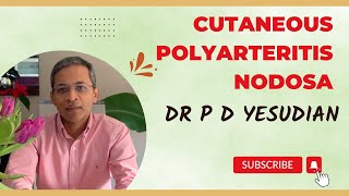 Cutaneous polyarteritis nodosa  a comprehensive review Dermatologist explains [upl. by Vitoria]