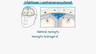 Nervesystemet Infektioner i centralnervesystemet [upl. by Velda956]