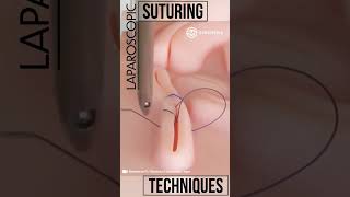 Laparoscopic Suturing Techniques shorts tech suture training laparoscopy medical medicine [upl. by Marienthal866]