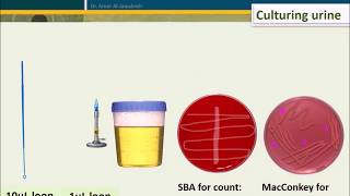 Urine Culture How To Interpret Count [upl. by Kolva960]