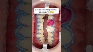 Estás a tiempo de realizarte un blanqueamiento dental 🦷 [upl. by Annwahs]