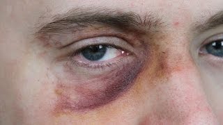 Black Eye Makeup SFX Beginners Tutorial [upl. by Ybor431]