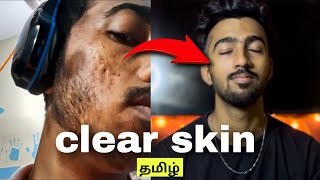 3 secret ways which I used to get clear skin  தமிழ்  clear skin in 3 week [upl. by Horgan]