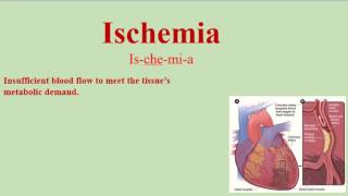 Ischemia Pronunciation and Definition  How to pronounce Ischemia [upl. by Niroht45]