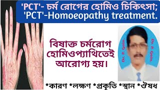 723 PCTবিষাক্ত চর্ম রোগের হোমিও চিকিৎসা  PCT Homoeopathy treatment [upl. by Quin]