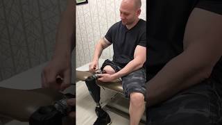 Osseointegration Limb Replacement Patient Jesse Levine  HSS [upl. by Bernadine399]