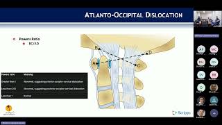 Occipitocervical Trauma  Gautham Prabhakar MD on September 23 2024 [upl. by Elke599]