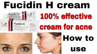 fucidin h cream uses in urdu For skin treatment of acne skin infectionsHow to use fusidin h cream [upl. by Rennerb103]