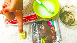 How to Remove Hair Dye From Skin Hair Dye Remover for Skin  How to Remove Hair Dye From Hands [upl. by Scheers]