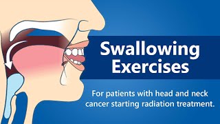 Swallowing Exercises  For Patients with Head and Neck Cancer Starting Radiation Treatment [upl. by Leach]