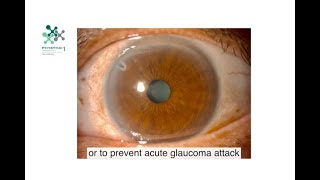 Glaucoma the silent thief of sight [upl. by Akerehs]