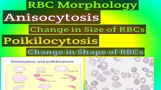 RBC MORPHOLOGY What is Anisocytosis What is Poikilocytosis [upl. by Znerol925]