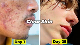 How to get clear skin in 28 days  Glowing skin [upl. by Dickinson297]