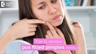 How to get rid of pus filled pimples  Dr Rasya Dixit [upl. by Link22]