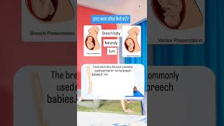 correct breech baby 👶🏻 naturally youtubeshorts breech pregação viralshorts [upl. by Simaj384]