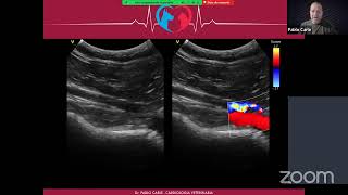 Webinar Ecocardiografia Doppler Veterinaria [upl. by Sane788]