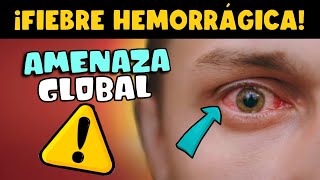 ¡CUIDADO FIEBRE HEMORRÁGICA UNA AMENAZA GLOBAL [upl. by Mcwilliams]