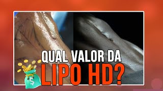 QUAL PREÇO DA LIPO HD  CIRURGIA PLÁSTICA [upl. by Quenby]