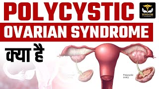 Polycystic Ovarian Syndrome क्या है  Wisdom Nursing Classes [upl. by Ayidah491]