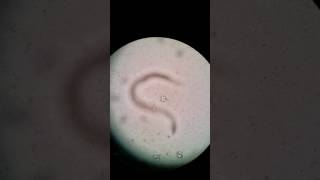 HookwormAncyclostoma Rhabditiform larvae Canine [upl. by Norehc]