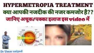 HYPERMETROPIA TREATMENT नजदीक की नजर कमजोर होना [upl. by Thagard88]