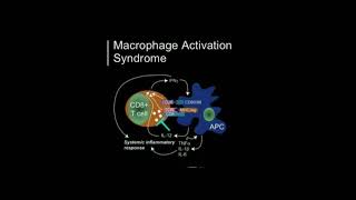 🍁 Macrophage Activation Syndrome 🍁 [upl. by Shannah]