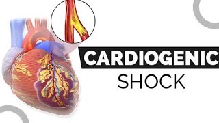 CARDIOGENIC SHOCK Lecture withsimple explanation 😇🥰 [upl. by Seldan]