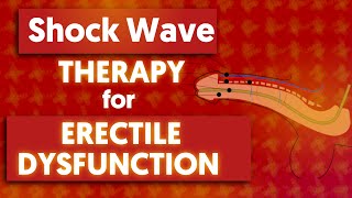 How Extracorporeal Shockwave Therapy Works [upl. by Alimrahs]