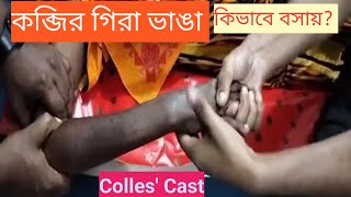 How to Reduce and Apply of Colles plaster cast in colles fracture [upl. by Kinimod]