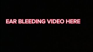 Ear bleeding video here [upl. by Hgielrahc]