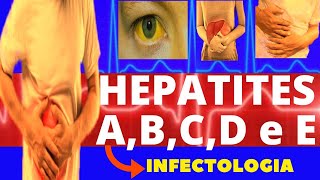 HEPATITES A B C D e E  CARACTERÍSTICAS SINTOMAS DIAGNÓSTICO E TRATAMENTO  INFECTOLOGIA [upl. by Arot]