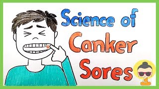 Why do we get canker sores Types  Prevention [upl. by Faletti929]