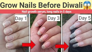 Grow Long Nails In 5 days  Nail Growth Serum for long and healthy nails  Glow Yourself💅 [upl. by Oznecniv]