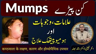 Mumps کن پیڑے कण्ठमाला का रोग Homeopathic Treatment Symptoms by DrWaqar Bhutta  Urdu  Hindi [upl. by Hindu357]