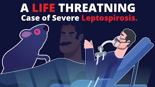 What is Leptospirosis How does it cause Organ Failure amp How to treat [upl. by Teri379]