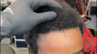 How I Fixed His Receding Widows Peak [upl. by Micky]