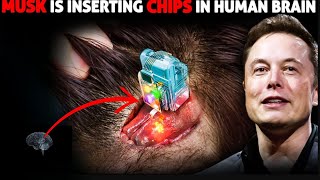 Elon Musks Bold Move  Unveiling Neuralinks Human Brain Implant Trials [upl. by Marco]