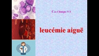 cas clinique corrigé en hémato N°3 leucémie aigue LA [upl. by Dowdell513]