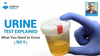 Urine Test Explained What You Need to Know [upl. by Rebmyk554]