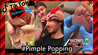 Over 20 Minutes Of Pimple Popping Black Heads Extractions TikTok Compilation  Part 13 [upl. by Landahl]