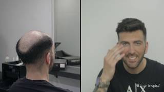 Antes y después de una prótesis capilar indetectable  Hair Inspira [upl. by Lamahj]