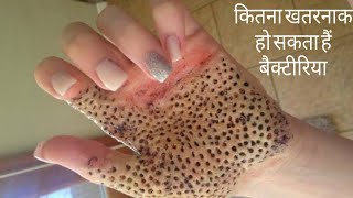 आखिर बैक्टीरिया क्या होता है  what is bacteria in hindi [upl. by Assirehc]