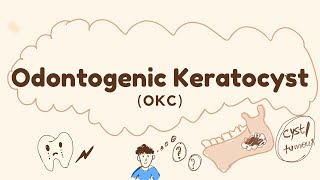 Odontogenic KeratocystOKCOdontogenic cyst [upl. by Bonneau]