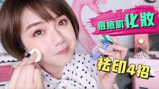 痘痘肌化妝＋去印 4個重點 AD ACNE COVERAGE MAKEUP TUTORIAL  沛莉 Peri [upl. by Lemraj]