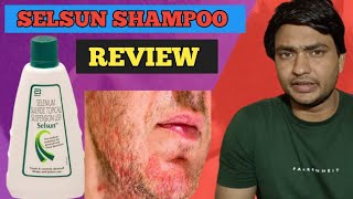 selsun shampoo use in hindi  selsun shampoo review [upl. by Nnaik]