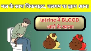 मल के साथ चिकनाहट बलगम या झाग आने के कारण latrine me aav aana blood wali potty aane ke reasons [upl. by Nhepets717]