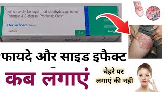 Dermiford Cream  dermiford cream kis kaam aati hai  Dermiford cream uses in Hindi  Side Effects [upl. by Steddman285]