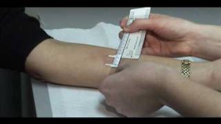 TB Skin Test  Mantoux Method [upl. by Ariaek]