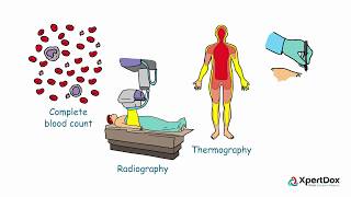 Spanish  ¿Qué es la eritromelalgia What is erythromelalgia [upl. by Odraode]